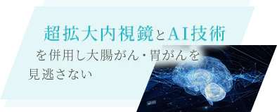 超拡大内視鏡とAI技術を併用し大腸がん・胃がんを見逃さない 