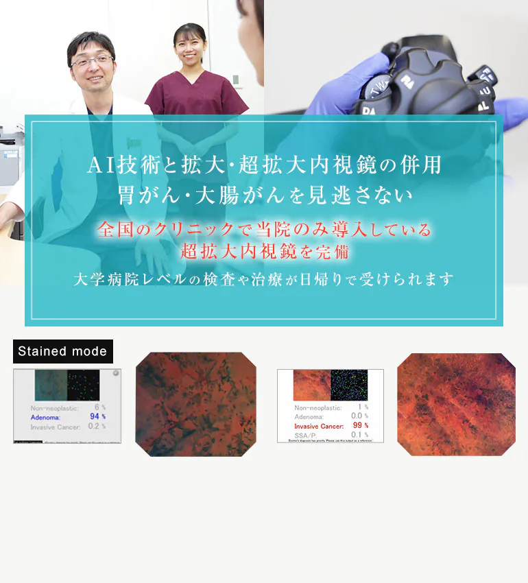 鎮静剤・鎮痛剤を使用して 最大限に苦痛を抑えて 寝ている間に終了する内視鏡検査 胃カメラ・大腸カメラで 消化器がんの早期発見・早期治療