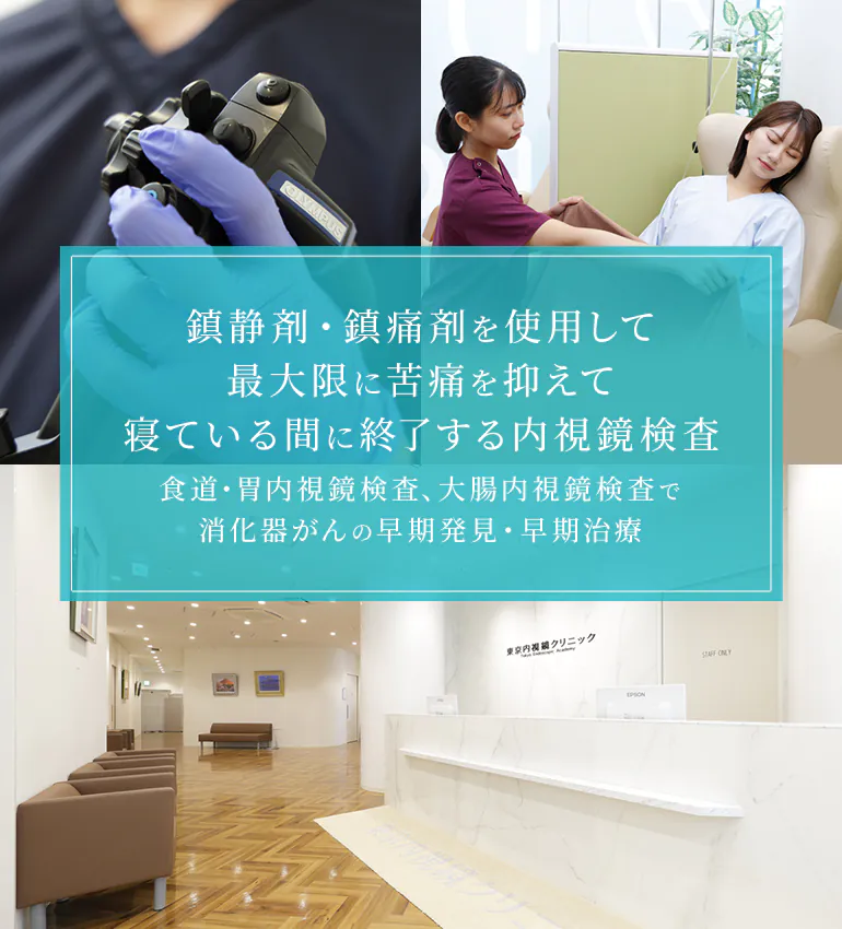 鎮静剤・鎮痛剤を使用して最大限に苦痛を抑えて寝ている間に終了する内視鏡検査 胃カメラ・大腸カメラで消化器がんの早期発見・早期治療